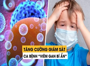 Việt Nam tăng cường giám sát ca bệnh viêm gan bí ẩn ở trẻ em